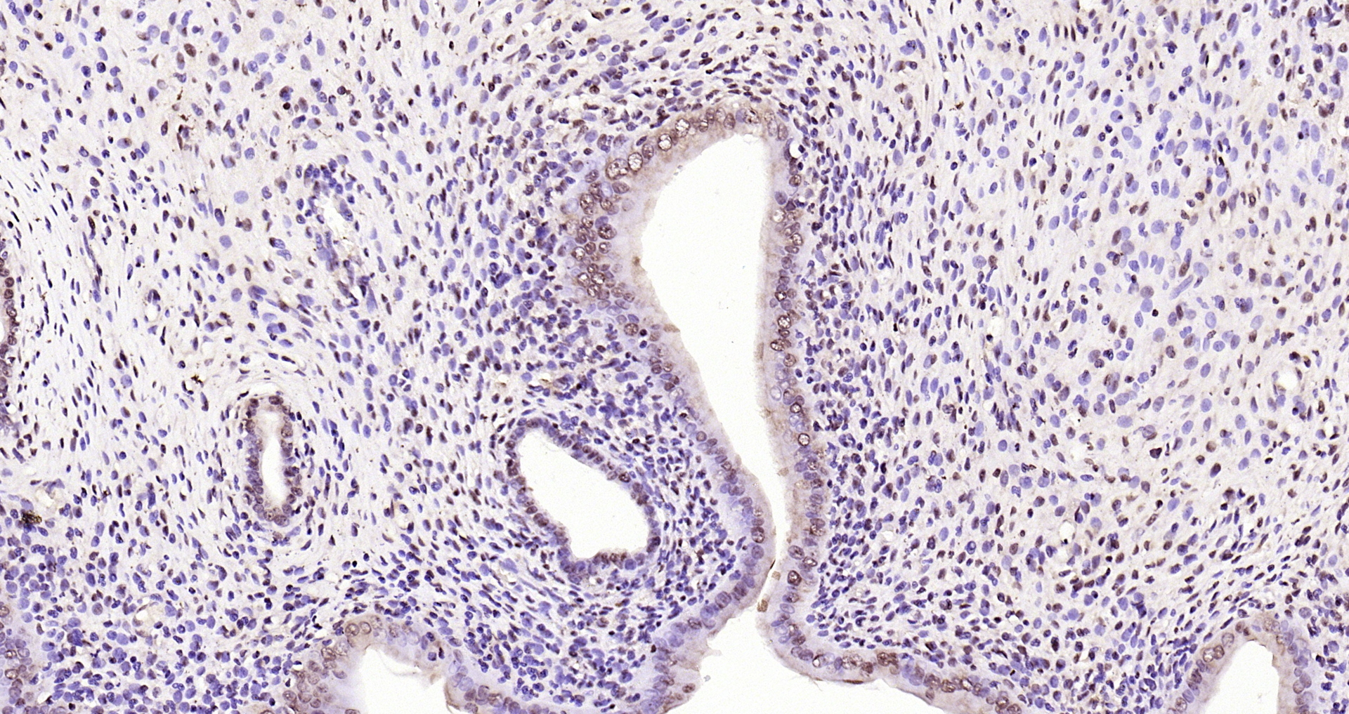 Paraformaldehyde-fixed, paraffin embedded Rat uterus; Antigen retrieval by boiling in sodium citrate buffer (pH6.0) for 15min; Block endogenous peroxidase by 3% hydrogen peroxide for 20 minutes; Blocking buffer (normal goat serum) at 37°C for 30min; Antibody incubation with IRS1(Ser1101) Polyclonal Antibody, Unconjugated (bs-3197R) at 1:200 overnight at 4°C, DAB staining.