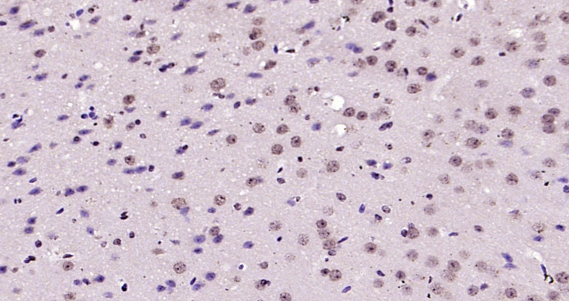 Paraformaldehyde-fixed, paraffin embedded Mouse brain; Antigen retrieval by boiling in sodium citrate buffer (pH6.0) for 15min; Block endogenous peroxidase by 3% hydrogen peroxide for 20 minutes; Blocking buffer (normal goat serum) at 37°C for 30min; Antibody incubation with IRS1(Ser1101) Polyclonal Antibody, Unconjugated (bs-3197R) at 1:200 overnight at 4°C, DAB staining.