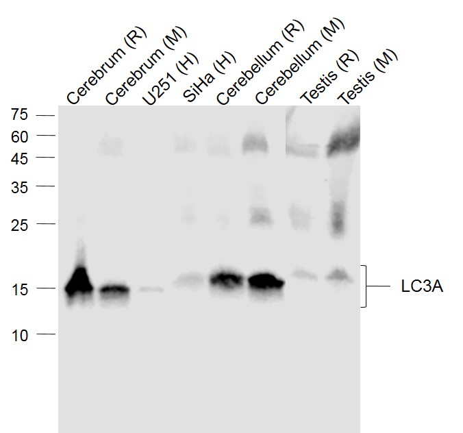 Lane 1: Rat Cerebrum lysates; Lane 2: Mouse Cerebrum lysates; Lane 3: Human U251 cell lysates; Lane 4: Human Siha cell lysates; Lane 5: Rat Cerebellum lysates; Lane 6: Mouse Cerebellum lysates; Lane 7: Rat Testis lysates; Lane 8: Mouse Testis lysates probed with LC3A Monoclonal Antibody, Unconjugated (bsm-33309M) at 1:1000 dilution and 4˚C overnight incubation. Followed by conjugated secondary antibody incubation at 1:20000 for 60 min at 37˚C.