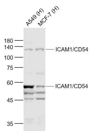 Lane 1: Human A549 cell lysates; Lane 2: Human MCF-7 cell lysates probed with ICAM1 Polyclonal Antibody, Unconjugated (bs-0608R) at 1:1000 dilution and 4˚C overnight incubation. Followed by conjugated secondary antibody incubation at 1:20000 for 60 min at 37˚C.