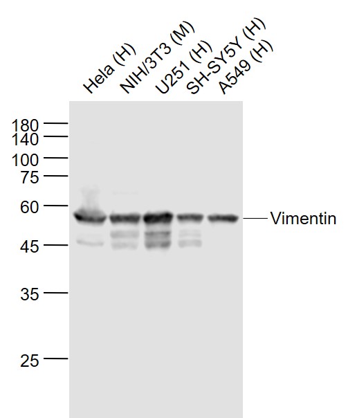 Lane 1: Human Hela cell lysates; Lane 2: Mouse NIH\/3T3 cell lysates; Lane 3: Human U251 cell lysates; Lane 4: Human SH-SY5Y cell lysates; Lane 5: Human A549 cell lysates probed with Vimentin Polyclonal  Antibody, Unconjugated (bs-0756R) at 1:1000 dilution and 4˚C overnight incubation. Followed by conjugated secondary antibody incubation at 1:20000 for 60 min at 37˚C