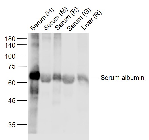 Lane 1: Human Serum; Lane 2: Mouse Serum; Lane 3: Rat Serum; Lane 4: Goat Serum; Lane 5: Rat Liver lysates probed with Serum albumin Polyclonal Antibody, Unconjugated (bs-0945R) at 1:1000 dilution and 4˚C overnight incubation. Followed by conjugated secondary antibody incubation at 1:20000 for 60 min at 37˚C