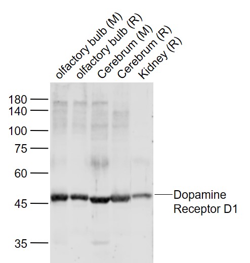 Lane 1: Mouse Olfactory bulb lysates; Lane 2: Rat Olfactory bulb lysates; Lane 3: Mouse Cerebrum lysates; Lane 4: Rat Cerebrum lysates; Lane 5: Rat Kidney lysates probed with DRD1 Polyclonal Antibody, Unconjugated (bs-1007R) at 1:1000 dilution and 4˚C overnight incubation. Followed by conjugated secondary antibody incubation at 1:20000 for 60 min at 37˚C
