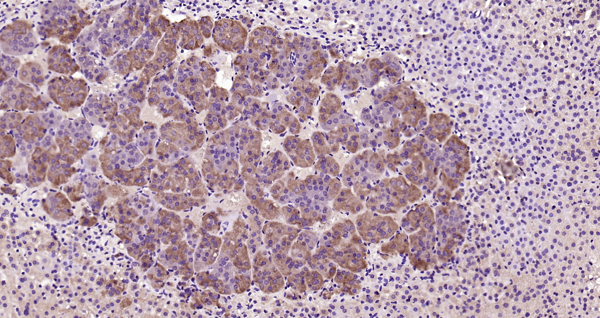 Paraformaldehyde-fixed, paraffin embedded Mouse adrenal gland; Antigen retrieval by boiling in sodium citrate buffer (pH6.0) for 15min; Block endogenous peroxidase by 3% hydrogen peroxide for 20 minutes; Blocking buffer (normal goat serum) at 37°C for 30min; Antibody incubation with CRF Polyclonal Antibody, Unconjugated (bs-0246R) at 1:200 overnight at 4°C, DAB staining. Paraformaldehyde-fixed, paraffin embedded Mouse adrenal gland; Antigen retrieval by boiling in sodium citrate buffer (pH6.0) for 15min; Block endogenous peroxidase by 3% hydrogen peroxide for 20 minutes; Blocking buffer (normal goat serum) at 37°C for 30min; Antibody incubation with CRF Polyclonal Antibody, Unconjugated (bs-0246R) at 1:200 overnight at 4°C, DAB staining.
