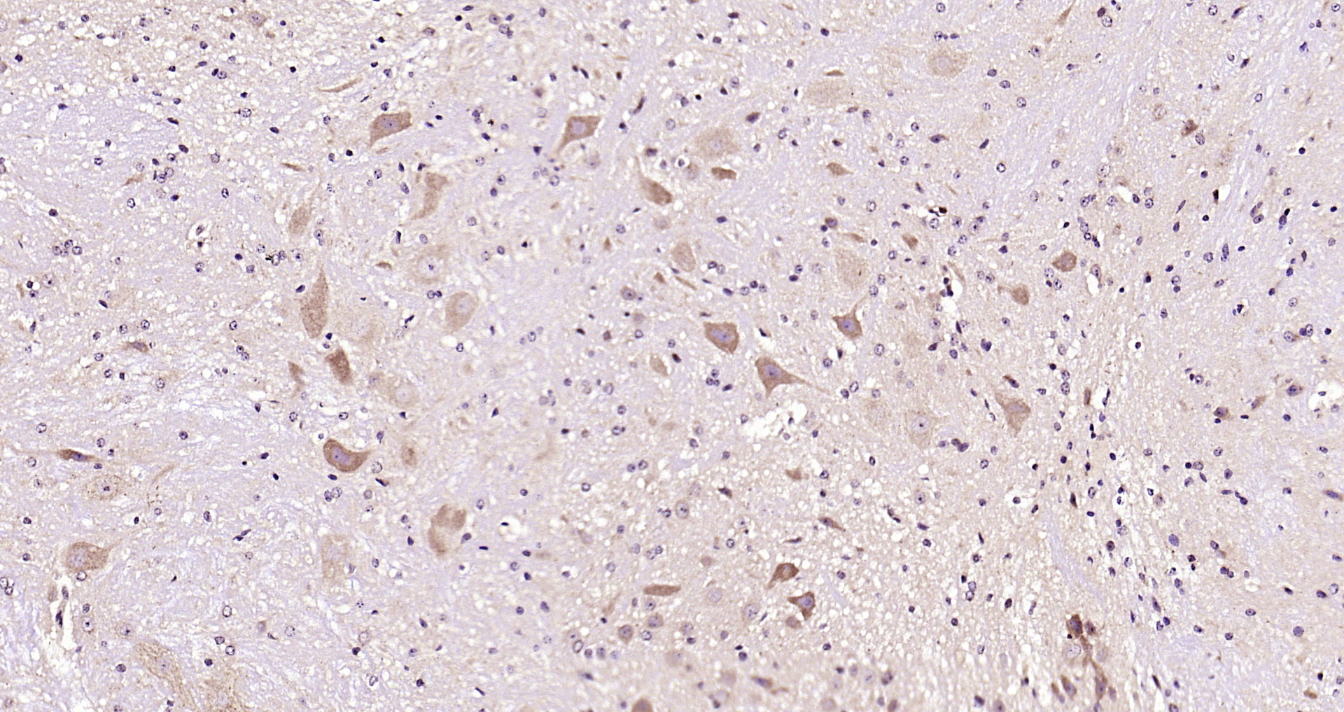 Paraformaldehyde-fixed, paraffin embedded Mouse cerebellum; Antigen retrieval by boiling in sodium citrate buffer (pH6.0) for 15min; Block endogenous peroxidase by 3% hydrogen peroxide for 20 minutes; Blocking buffer (normal goat serum) at 37°C for 30min; Antibody incubation with CRF Polyclonal Antibody, Unconjugated (bs-0246R) at 1:200 overnight at 4°C, DAB staining.