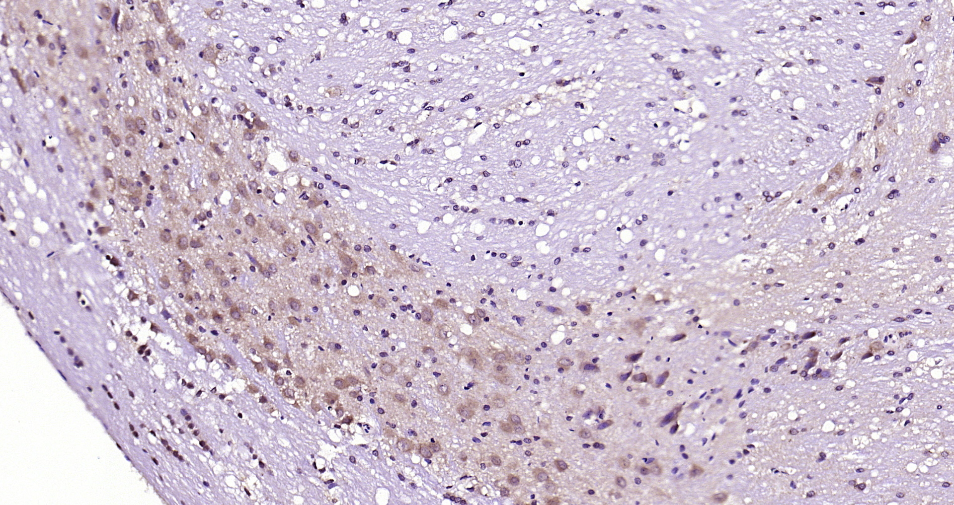 Paraformaldehyde-fixed, paraffin embedded Rat cerebellum; Antigen retrieval by boiling in sodium citrate buffer (pH6.0) for 15min; Block endogenous peroxidase by 3% hydrogen peroxide for 20 minutes; Blocking buffer (normal goat serum) at 37°C for 30min; Antibody incubation with CRF Polyclonal Antibody, Unconjugated (bs-0246R) at 1:200 overnight at 4°C, DAB staining.