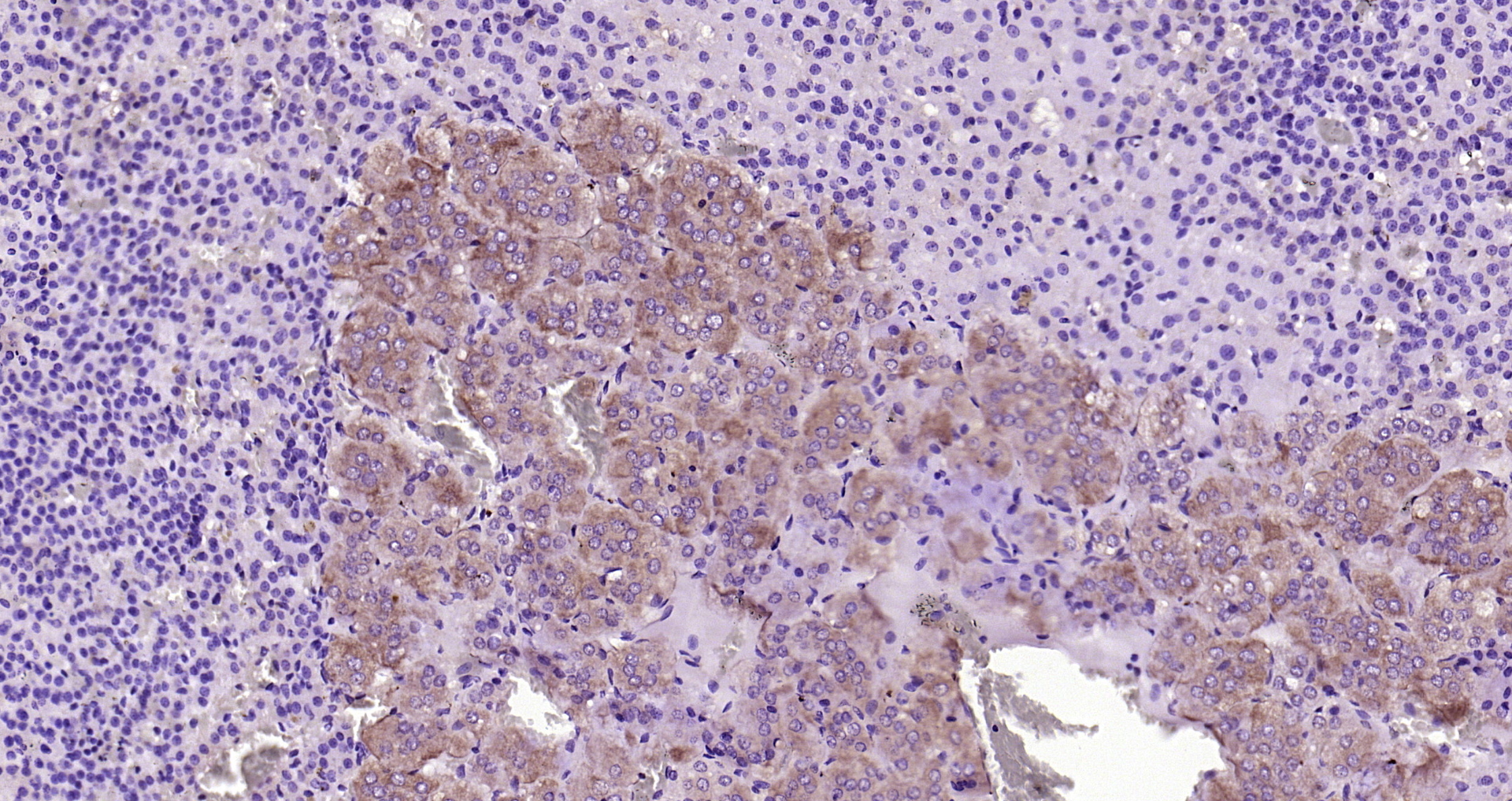 Paraformaldehyde-fixed, paraffin embedded Rat adrenal gland; Antigen retrieval by boiling in sodium citrate buffer (pH6.0) for 15min; Block endogenous peroxidase by 3% hydrogen peroxide for 20 minutes; Blocking buffer (normal goat serum) at 37°C for 30min; Antibody incubation with CRF Polyclonal Antibody, Unconjugated (bs-0246R) at 1:200 overnight at 4°C, DAB staining.