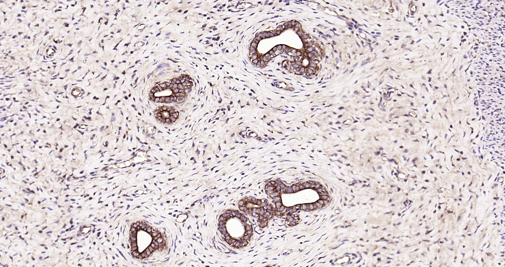 Paraformaldehyde-fixed, paraffin embedded Rat uterus; Antigen retrieval by boiling in sodium citrate buffer (pH6.0) for 15min; Block endogenous peroxidase by 3% hydrogen peroxide for 20 minutes; Blocking buffer (normal goat serum) at 37°C for 30min; Antibody incubation with CK18 Polyclonal Antibody, Unconjugated (bs-1339R) at 1:200 overnight at 4°C, DAB staining.
