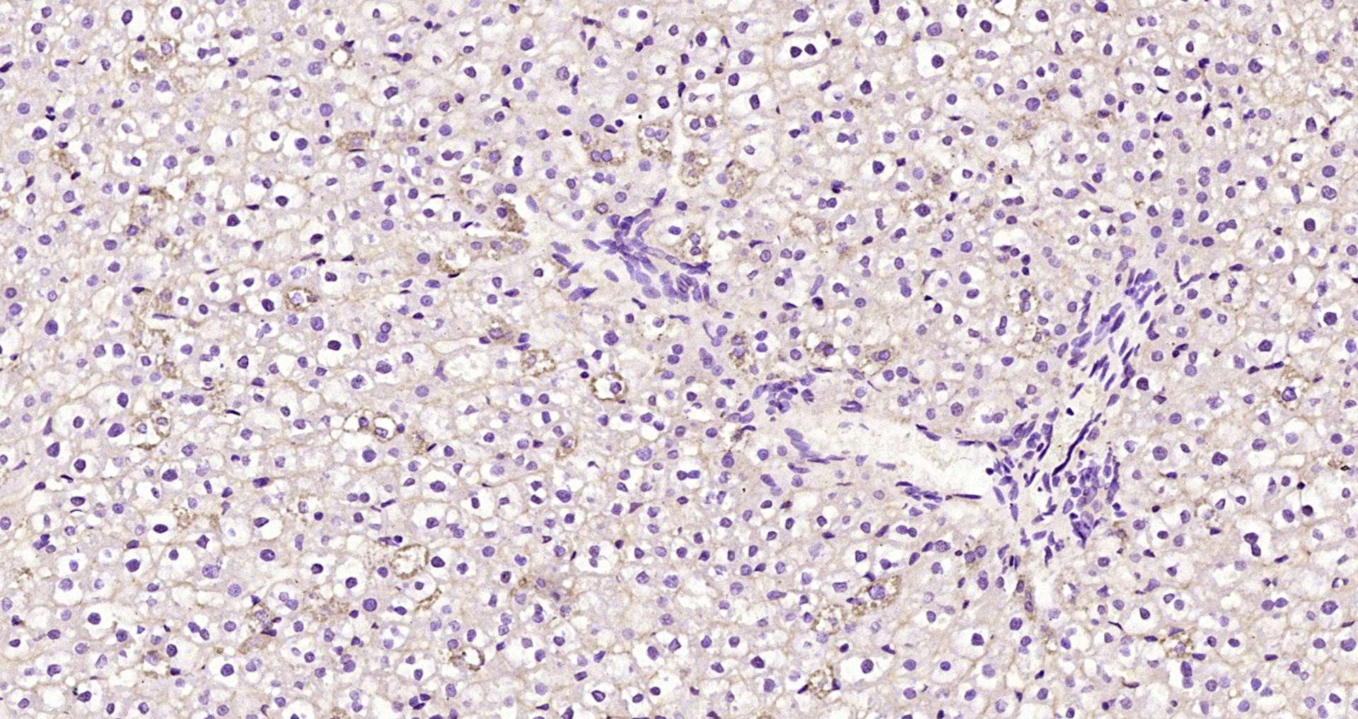 Paraformaldehyde-fixed, paraffin embedded Rat liver; Antigen retrieval by boiling in sodium citrate buffer (pH6.0) for 15min; Block endogenous peroxidase by 3% hydrogen peroxide for 20 minutes; Blocking buffer (normal goat serum) at 37°C for 30min; Antibody incubation with Radixin Polyclonal Antibody, Unconjugated (bs-3808R) at 1:200 overnight at 4°C, DAB staining.