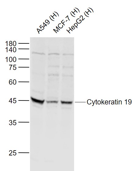 Lane 1: Human A549 cell lysates; Lane 2: Human MCF-7 cell lysates; Lane 3: Human HepG2 cell lysates probed with pan-Cytokeratin Polyclonal Antibody, Unconjugated (bs-2190R) at 1:1000 dilution and 4˚C overnight incubation. Followed by conjugated secondary antibody incubation at 1:20000 for 60 min at 37˚C.