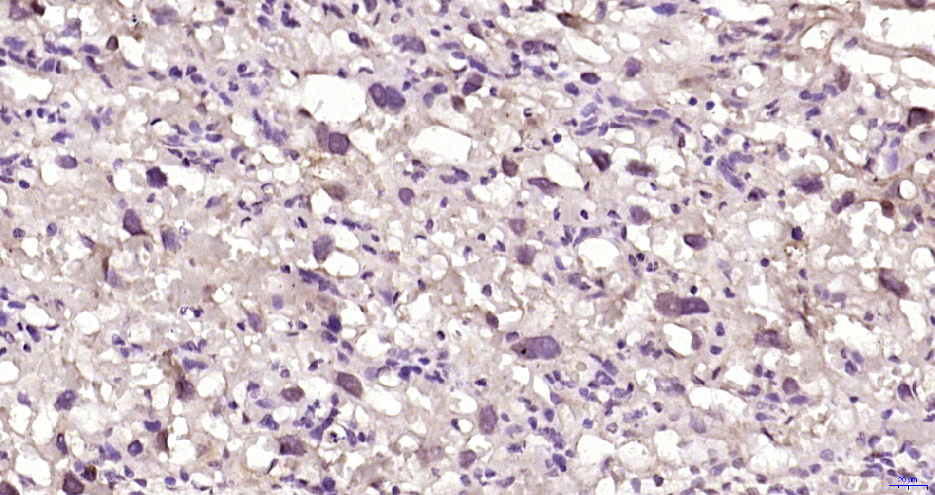 Paraformaldehyde-fixed, paraffin embedded Rat placenta; Antigen retrieval by boiling in sodium citrate buffer (pH6.0) for 15min; Block endogenous peroxidase by 3% hydrogen peroxide for 20 minutes; Blocking buffer (normal goat serum) at 37°C for 30min; Antibody incubation with DAG1 (Tyr892) Polyclonal Antibody, Unconjugated (bs-4075R) at 1:200 overnight at 4°C, DAB staining.