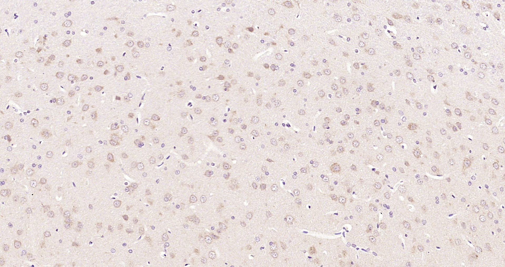 Paraformaldehyde-fixed, paraffin embedded Rat brain; Antigen retrieval by boiling in sodium citrate buffer (pH6.0) for 15min; Block endogenous peroxidase by 3% hydrogen peroxide for 20 minutes; Blocking buffer (normal goat serum) at 37°C for 30min; Antibody incubation with MEK5 Polyclonal Antibody, Unconjugated (bs-4124R) at 1:200 overnight at 4°C, DAB staining.