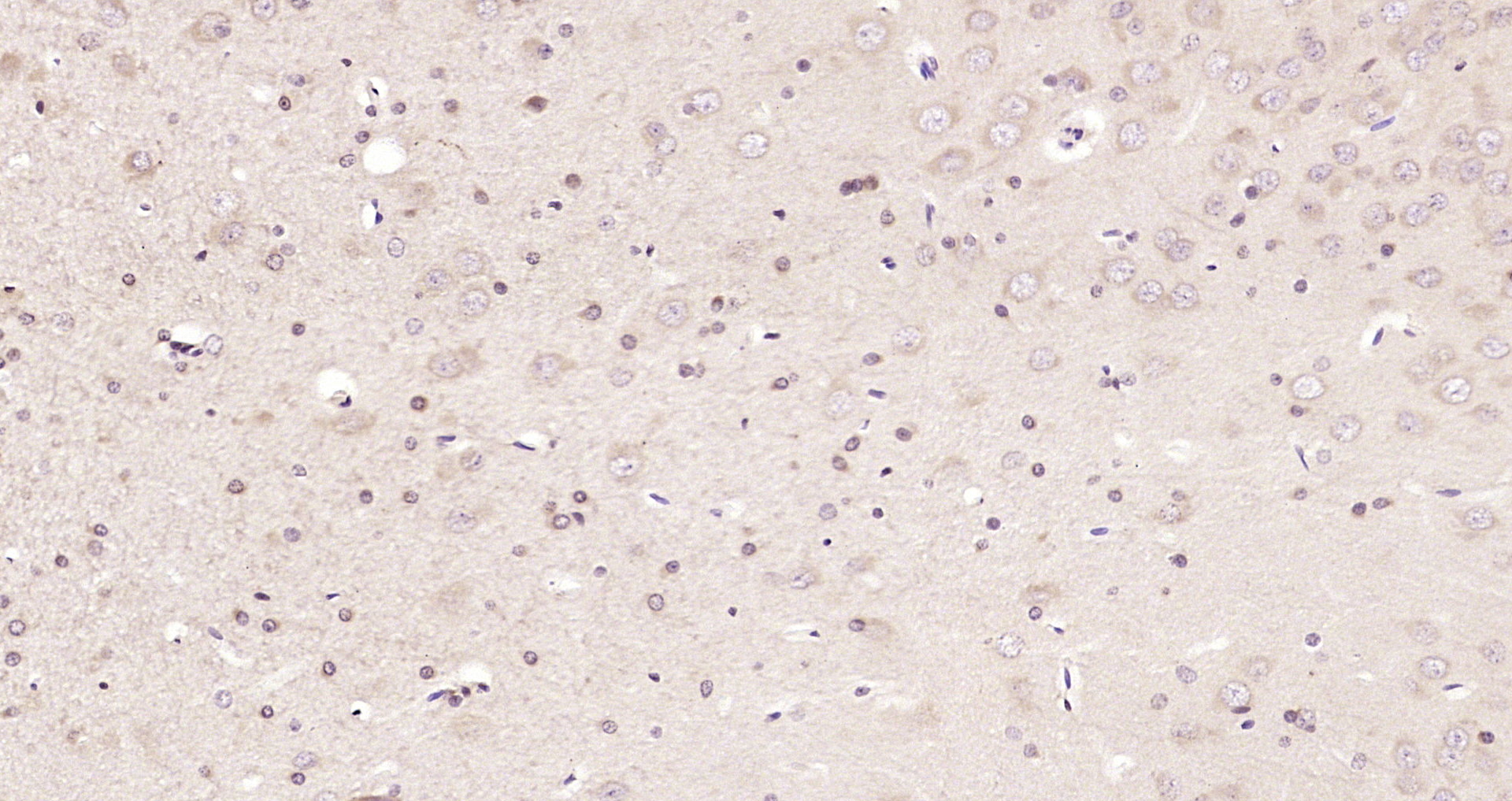 Paraformaldehyde-fixed, paraffin embedded Rat brain; Antigen retrieval by boiling in sodium citrate buffer (pH6.0) for 15min; Block endogenous peroxidase by 3% hydrogen peroxide for 20 minutes; Blocking buffer (normal goat serum) at 37°C for 30min; Antibody incubation with MAPKAPK5 Polyclonal Antibody, Unconjugated (bs-4137R) at 1:200 overnight at 4°C, DAB staining.