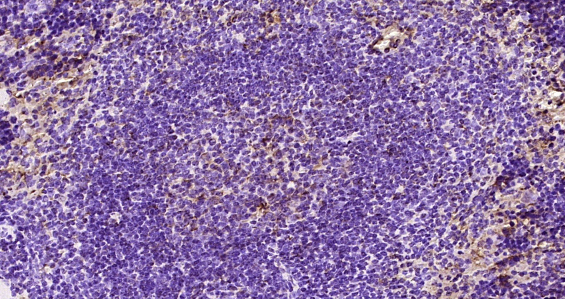 Paraformaldehyde-fixed, paraffin embedded Mouse spleen; Antigen retrieval by boiling in sodium citrate buffer (pH6.0) for 15min; Block endogenous peroxidase by 3% hydrogen peroxide for 20 minutes; Blocking buffer (normal goat serum) at 37°C for 30min; Antibody incubation with MAPKAPK5 Polyclonal Antibody, Unconjugated (bs-4137R) at 1:200 overnight at 4°C, DAB staining.