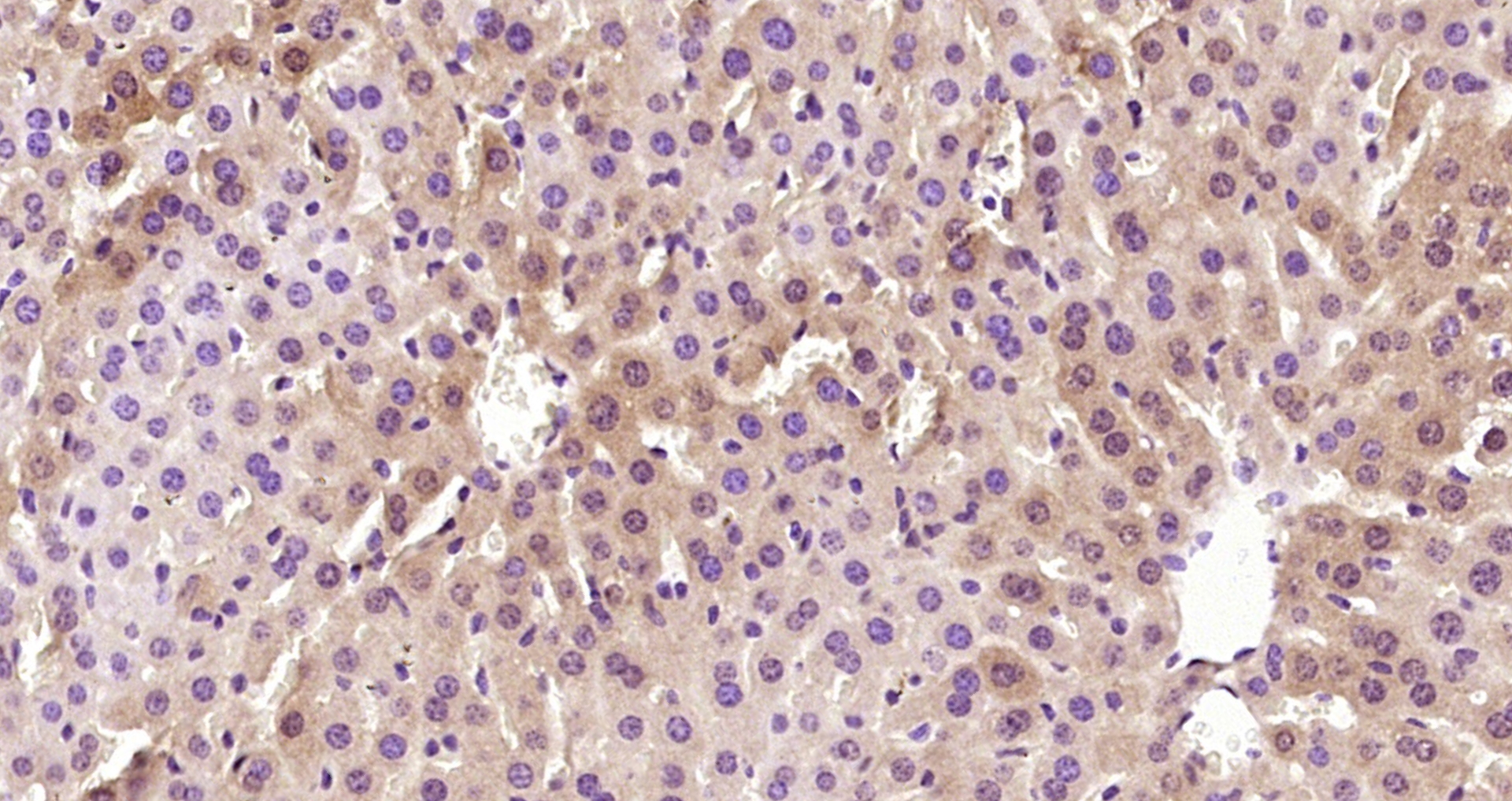 Paraformaldehyde-fixed, paraffin embedded Mouse liver; Antigen retrieval by boiling in sodium citrate buffer (pH6.0) for 15min; Block endogenous peroxidase by 3% hydrogen peroxide for 20 minutes; Blocking buffer (normal goat serum) at 37°C for 30min; Antibody incubation with Selenium Binding Protein 1 Polyclonal Antibody, Unconjugated (bs-4200R) at 1:200 overnight at 4°C, DAB staining. Paraformaldehyde-fixed, paraffin embedded Mouse liver; Antigen retrieval by boiling in sodium citrate buffer (pH6.0) for 15min; Block endogenous peroxidase by 3% hydrogen peroxide for 20 minutes; Blocking buffer (normal goat serum) at 37°C for 30min; Antibody incubation with Selenium Binding Protein 1 Polyclonal Antibody, Unconjugated (bs-4200R) at 1:200 overnight at 4°C, DAB staining.