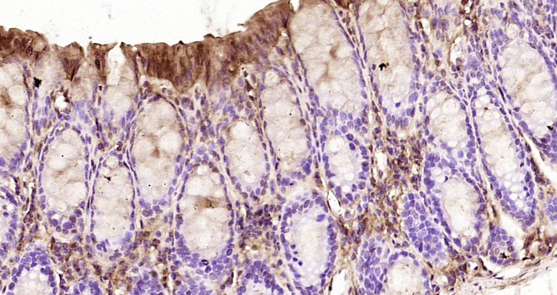 Paraformaldehyde-fixed, paraffin embedded Mouse colon; Antigen retrieval by boiling in sodium citrate buffer (pH6.0) for 15min; Block endogenous peroxidase by 3% hydrogen peroxide for 20 minutes; Blocking buffer (normal goat serum) at 37°C for 30min; Antibody incubation with Selenium Binding Protein 1 Polyclonal Antibody, Unconjugated (bs-4200R) at 1:200 overnight at 4°C, DAB staining. Paraformaldehyde-fixed, paraffin embedded Mouse colon; Antigen retrieval by boiling in sodium citrate buffer (pH6.0) for 15min; Block endogenous peroxidase by 3% hydrogen peroxide for 20 minutes; Blocking buffer (normal goat serum) at 37°C for 30min; Antibody incubation with Selenium Binding Protein 1 Polyclonal Antibody, Unconjugated (bs-4200R) at 1:200 overnight at 4°C, DAB staining.