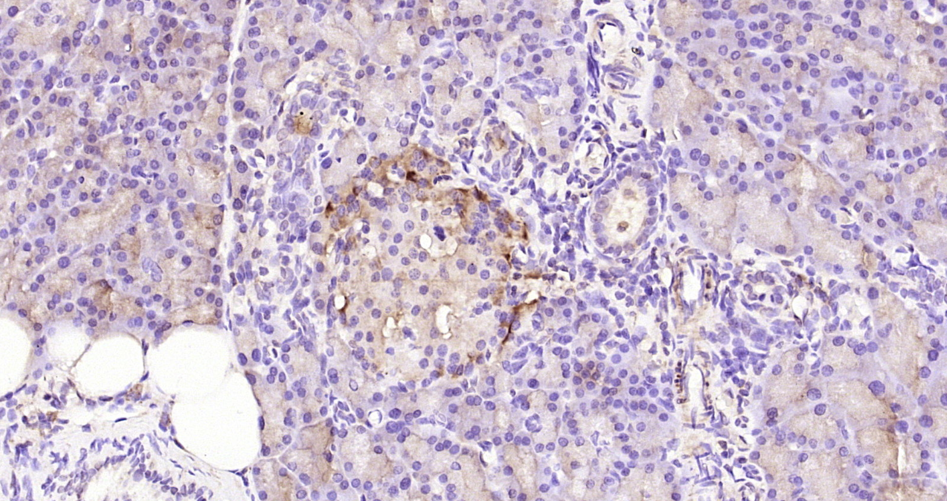 Paraformaldehyde-fixed, paraffin embedded Rat pancreas; Antigen retrieval by boiling in sodium citrate buffer (pH6.0) for 15min; Block endogenous peroxidase by 3% hydrogen peroxide for 20 minutes; Blocking buffer (normal goat serum) at 37°C for 30min; Antibody incubation with ABAT Polyclonal Antibody, Unconjugated (bs-4234R) at 1:200 overnight at 4°C, DAB staining.