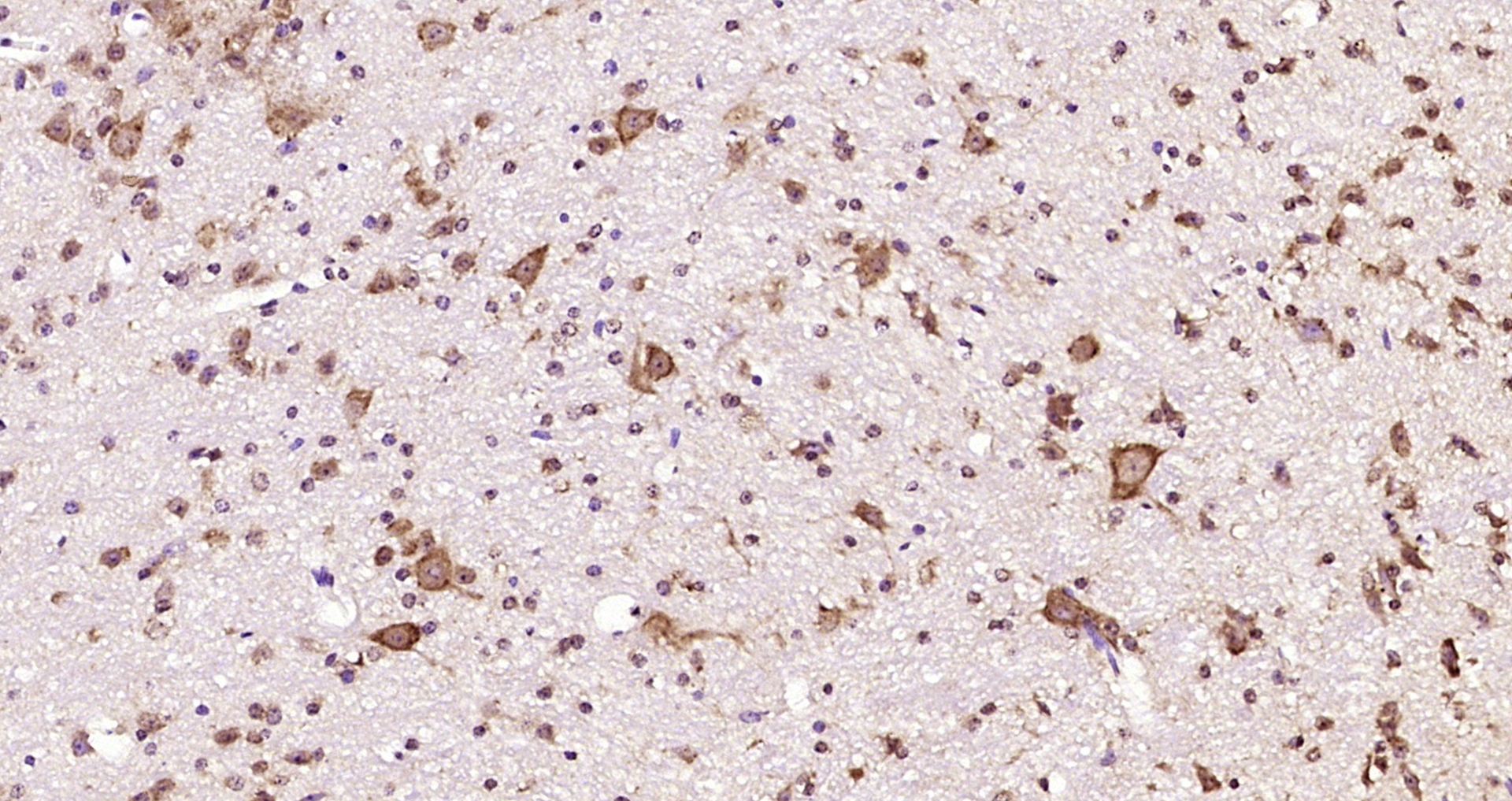 Paraformaldehyde-fixed, paraffin embedded Mouse cerebellum; Antigen retrieval by boiling in sodium citrate buffer (pH6.0) for 15min; Block endogenous peroxidase by 3% hydrogen peroxide for 20 minutes; Blocking buffer (normal goat serum) at 37°C for 30min; Antibody incubation with ABAT Polyclonal Antibody, Unconjugated (bs-4234R) at 1:200 overnight at 4°C, DAB staining.