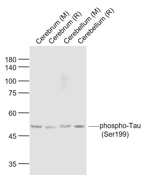Lane 1: Mouse Cerebrum lysates; Lane 2: Rat Cerebrum lysates; Lane 3: Mouse Cerebellum lysates; Lane 4: Rat Cerebellum lysates probed with Tau protein Polyclonal Antibody, Unconjugated (bs-5417R) at 1:1000 dilution and 4˚C overnight incubation. Followed by conjugated secondary antibody incubation at 1:20000 for 60 min at 37˚C.