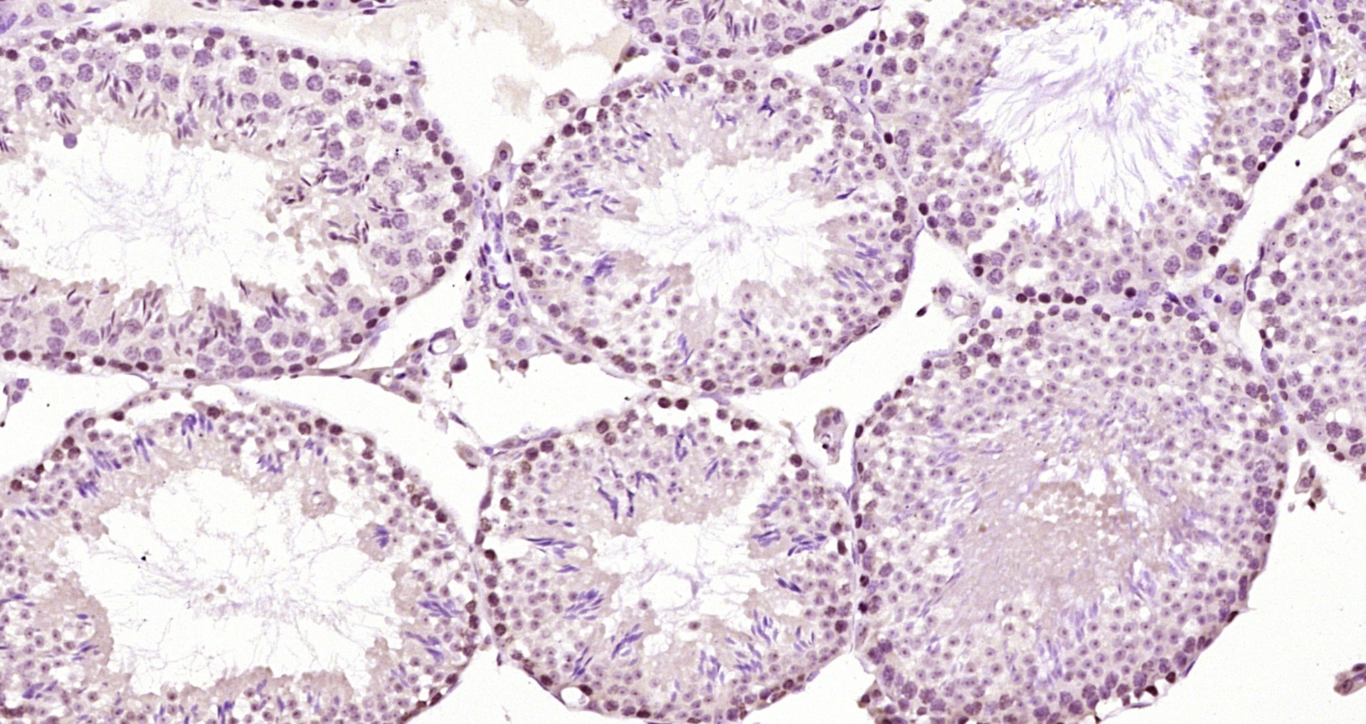 Paraformaldehyde-fixed, paraffin embedded Mouse testis; Antigen retrieval by boiling in sodium citrate buffer (pH6.0) for 15min; Block endogenous peroxidase by 3% hydrogen peroxide for 20 minutes; Blocking buffer (normal goat serum) at 37°C for 30min; Antibody incubation with Bub1 Polyclonal Antibody, Unconjugated (bs-4294R) at 1:200 overnight at 4°C, DAB staining.