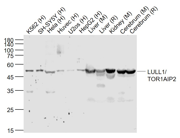 Lane 1: Human K562 cell lysates; Lane 2: Human SH-SY5Y cell lysates; Lane 3: Human Hela cell lysates; Lane 4: Human HUVEC cell lysates; Lane 5: Human U-2OS cell lysates; Lane 6: Human HepG2 cell lysates; Lane 7: Mouse Liver lysates; Lane 8: Rat Liver lysates; Lane 9: Mouse Kidney lysates; Lane 10: Mouse Cerebrum lysates; Lane 11: Rat Cerebrum lysates probed with TOR1AIP2 Polyclonal Antibody, Unconjugated (bs-17326R) at 1:1000 dilution and 4˚C overnight incubation. Followed by conjugated secondary antibody incubation at 1:20000 for 60 min at 37˚C.