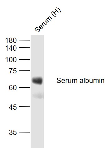 Lane 1:Human Serum probed with Serum albumin Monoclonal Antibody, Unconjugated (bsm-0945M) at 1:1000 dilution and 4˚C overnight incubation. Followed by conjugated secondary antibody incubation at 1:20000 for 60 min at 37˚C.