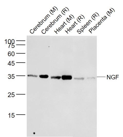 Lane 1: Mouse Cerebrum lysates; Lane 2: Rat Cerebrum lysates; Lane 3: Mouse Heart lysates; Lane 4: Rat Heart lysates; Lane 5: Rat Spleen lysates; Lane 6: Mouse Placenta lysates probed with NGF (11G1) Monoclonal Antibody, Unconjugated (bsm-52362R) at 1:1000 dilution and 4˚C overnight incubation. Followed by conjugated secondary antibody incubation at 1:20000 for 60 min at 37˚C.