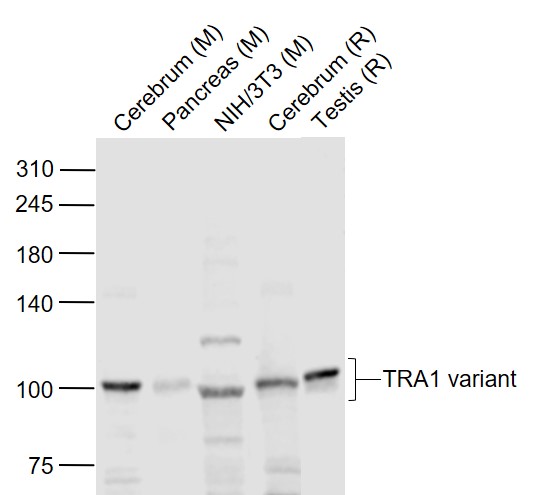 Lane 1: Mouse Cerebrum lysates; Lane 2: Mouse Pancreas lysates; Lane 3: Mouse NIH/3T3 cell lysates; Lane 4: Rat Cerebrum lysates; Lane 5: Rat Testis lysates probed with TRA1 variant Polyclonal Antibody, Unconjugated (bs-0149R) at 1:1000 dilution and 4˚C overnight incubation. Followed by conjugated secondary antibody incubation at 1:20000 for 60 min at 37˚C.