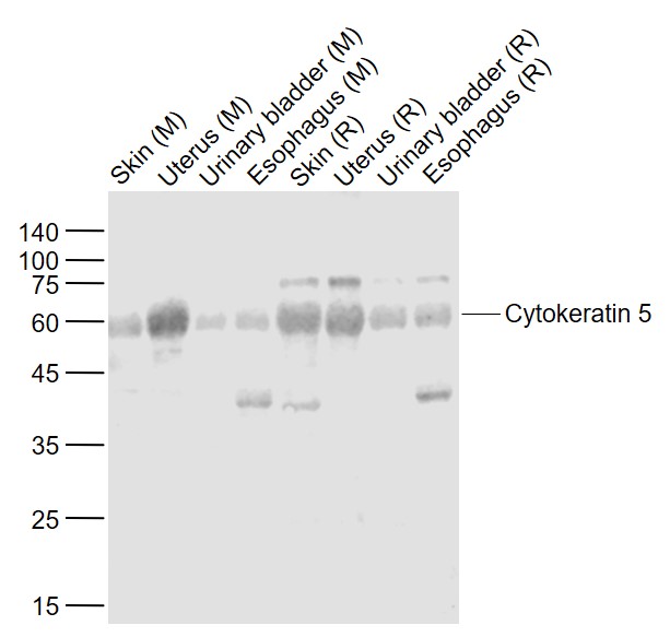 Lane 1: Mouse Skin lysates; Lane 2: Mouse Uterus lysates; Lane 3: Mouse Urinary bladder lysates; Lane 4: Mouse Esophagus lysates; Lane 5: Rat Skin lysates; Lane 6: Rat Uterus lysates; Lane 7: Rat Urinary bladder lysates; Lane 8: Rat Esophagus probed with Cytokeratin 5 Polyclonal Antibody, Unconjugated (bs-1060R) at 1:1000 dilution and 4˚C overnight incubation. Followed by conjugated secondary antibody incubation at 1:20000 for 60 min at 37˚C.