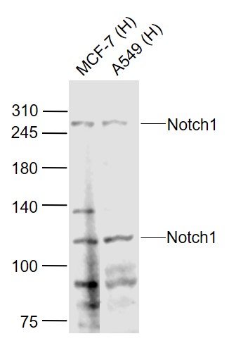 Lane 1: Human MCF-7 cell lysates; Lane 2: Human A549 cell lysates probed with Notch1/MOTC Polyclonal Antibody, Unconjugated (bs-1335R) at 1:1000 dilution and 4˚C overnight incubation. Followed by conjugated secondary antibody incubation at 1:20000 for 60 min at 37˚C.