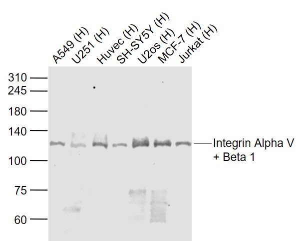 Lane 1: Human A549 cell lysates; Lane 2: Human U251 cell lysates; Lane 3: Human HUVEC cell lysates; Lane 4: Human SH-SY5Y cell lysates; Lane 5: Human U-2OS cell lysates; Lane 6: Human MCF-7 cell lysates; Lane 7: Human Jurkat cell lysates probed with Integrin Alpha V + Beta1 Polyclonal Antibody, Unconjugated (bs-2016R) at 1:1000 dilution and 4˚C overnight incubation. Followed by conjugated secondary antibody incubation at 1:20000 for 60 min at 37˚C. Lane 1: Human A549 cell lysates; Lane 2: Human U251 cell lysates; Lane 3: Human HUVEC cell lysates; Lane 4: Human SH-SY5Y cell lysates; Lane 5: Human U-2OS cell lysates; Lane 6: Human MCF-7 cell lysates; Lane 7: Human Jurkat cell lysates probed with Integrin Alpha V + Beta1 Polyclonal Antibody, Unconjugated (bs-2016R) at 1:1000 dilution and 4˚C overnight incubation. Followed by conjugated secondary antibody incubation at 1:20000 for 60 min at 37˚C.
