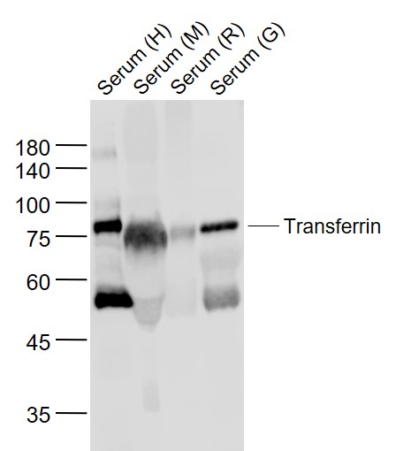 Lane 1: Human Serum; Lane 2: Mouse Serum; Lane 3: Rat Serum; Lane 4: Goat Serum probed with Transferrin Polyclonal Antibody, Unconjugated (bs-2052R) at 1:1000 dilution and 4˚C overnight incubation. Followed by conjugated secondary antibody incubation at 1:20000 for 60 min at 37˚C. Lane 1: Human Serum; Lane 2: Mouse Serum; Lane 3: Rat Serum; Lane 4: Goat Serum probed with Transferrin Polyclonal Antibody, Unconjugated (bs-2052R) at 1:1000 dilution and 4˚C overnight incubation. Followed by conjugated secondary antibody incubation at 1:20000 for 60 min at 37˚C.