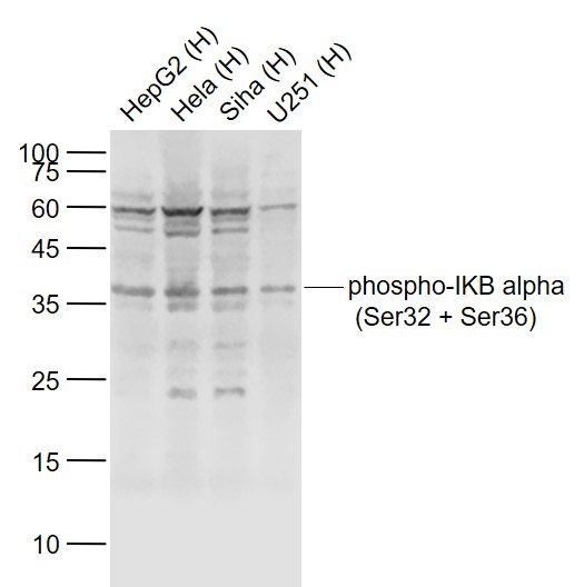 Lane 1: Human HepG2 cell lysates; Lane 2: Human Hela cell lysates; Lane 3: Human Siha cell lysates; Lane 4: Human U251 cell lysates probed with NFKBIA Polyclonal Antibody, Unconjugated (bs-2513R) at 1:1000 dilution and 4˚C overnight incubation. Followed by conjugated secondary antibody incubation at 1:20000 for 60 min at 37˚C.
