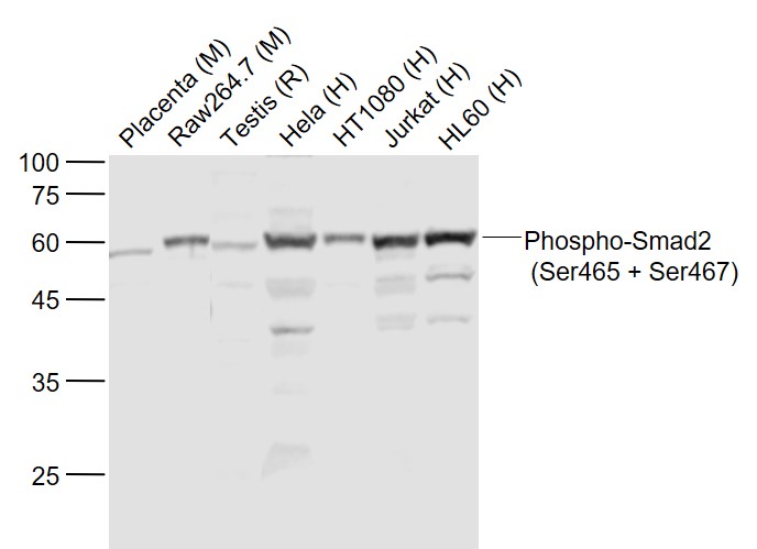 Lane 1: Mouse Placenta lysates; Lane 2: Mouse RAW264.7 cell lysates; Lane 3: Rat Testis lysates; Lane 4: Human Hela cell lysates; Lane 5: Human HT1080 cell lysates; Lane 6: Human Jurkat cell lysates; Lane 7: Human HL-60 cell lysates probed with Smad2 Polyclonal Antibody, Unconjugated (bs-3419R) at 1:1000 dilution and 4˚C overnight incubation. Followed by conjugated secondary antibody incubation at 1:20000 for 60 min at 37˚C.