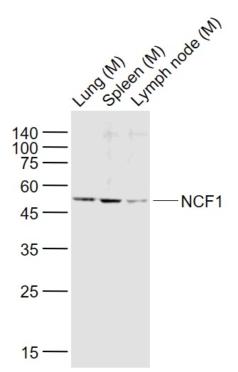 Lane 1: Mouse Lung lysates; Lane 2: Mouse Spleen lysates; Lane 3: Mouse Lymph node lysates probed with NCF1/p47 phox Polyclonal Antibody, Unconjugated (bs-3886R) at 1:1000 dilution and 4˚C overnight incubation. Followed by conjugated secondary antibody incubation at 1:20000 for 60 min at 37˚C.