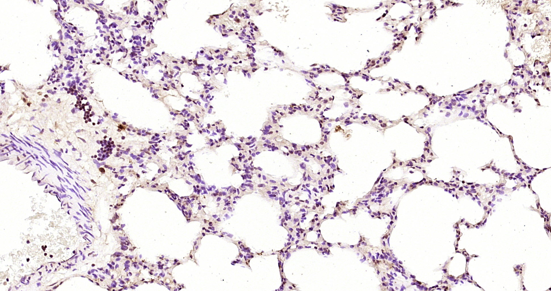 Paraformaldehyde-fixed, paraffin embedded Rat lung; Antigen retrieval by boiling in sodium citrate buffer (pH6.0) for 15min; Block endogenous peroxidase by 3% hydrogen peroxide for 20 minutes; Blocking buffer (normal goat serum) at 37°C for 30min; Antibody incubation with NR0B2 Polyclonal Antibody, Unconjugated (bs-4311R) at 1:200 overnight at 4°C, DAB staining.