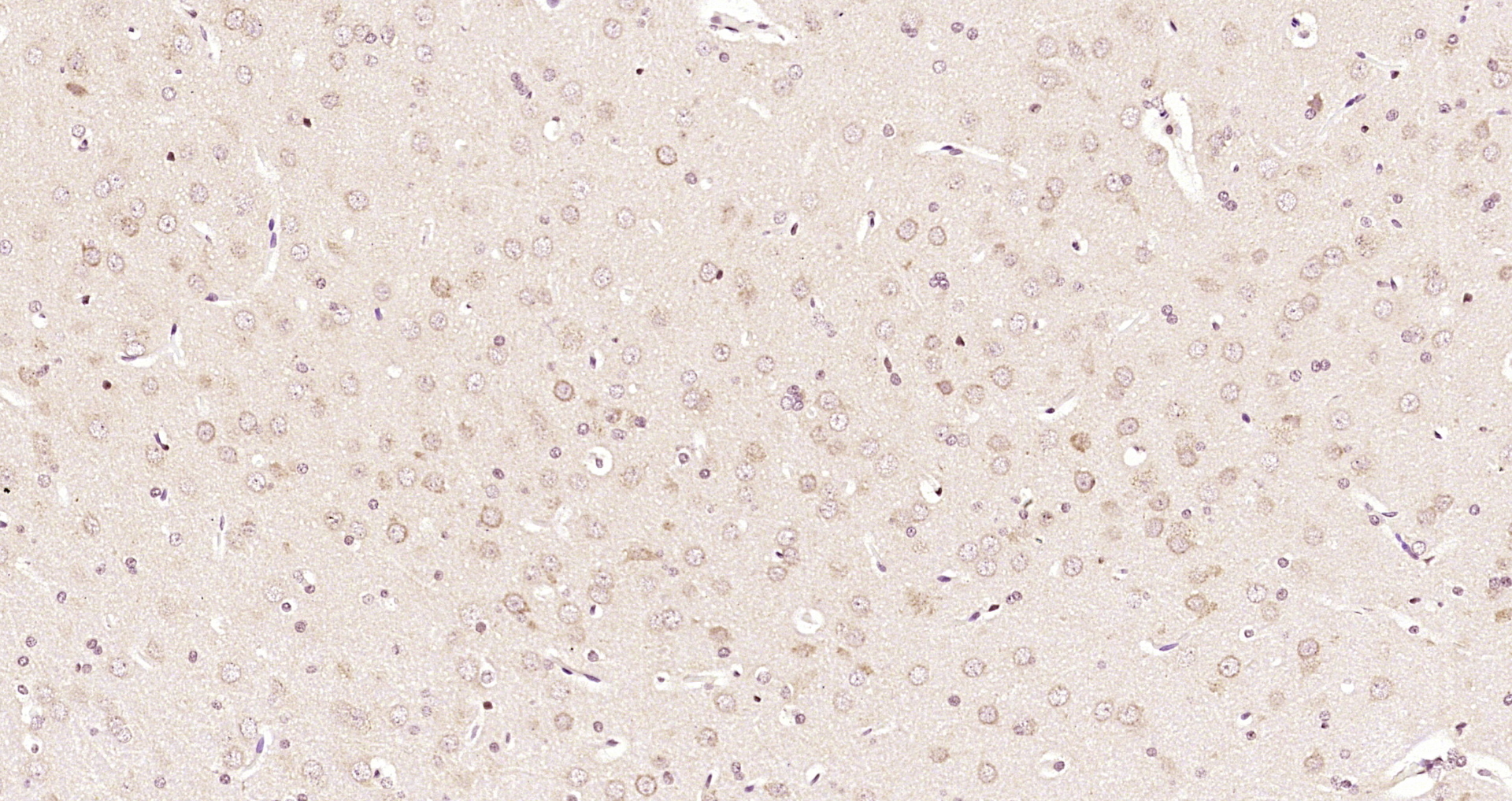 Paraformaldehyde-fixed, paraffin embedded Rat brain; Antigen retrieval by boiling in sodium citrate buffer (pH6.0) for 15min; Block endogenous peroxidase by 3% hydrogen peroxide for 20 minutes; Blocking buffer (normal goat serum) at 37°C for 30min; Antibody incubation with NR0B2 Polyclonal Antibody, Unconjugated (bs-4311R) at 1:200 overnight at 4°C, DAB staining.