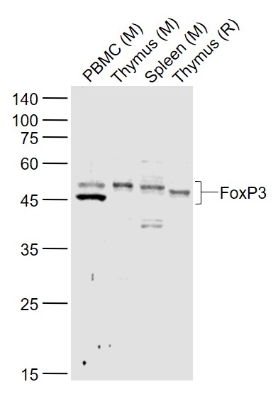 Lane 1: Mouse PBMC cell lysates; Lane 2: Mouse Thymus lysates; Lane 3: Mouse Spleen lysates; Lane 4: Rat Thymus lysates probed with FoxP3 Polyclonal Antibody, Unconjugated (bs-10211R) at 1:1000 dilution and 4˚C overnight incubation. Followed by conjugated secondary antibody incubation at 1:20000 for 60 min at 37˚C.