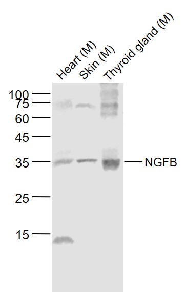 Lane 1: Mouse Heart lysates; Lane 2: Mouse Skin lysates; Lane 3: Mouse Thyroid gland lysates probed with NGFB Polyclonal Antibody, Unconjugated (bs-10806R) at 1:1000 dilution and 4˚C overnight incubation. Followed by conjugated secondary antibody incubation at 1:20000 for 60 min at 37˚C.