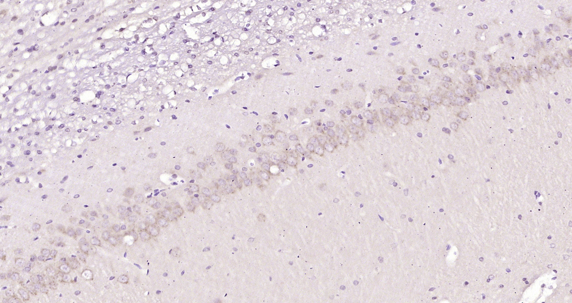 Paraformaldehyde-fixed, paraffin embedded Rat brain; Antigen retrieval by boiling in sodium citrate buffer (pH6.0) for 15min; Block endogenous peroxidase by 3% hydrogen peroxide for 20 minutes; Blocking buffer (normal goat serum) at 37°C for 30min; Antibody incubation with DNAJB6 Polyclonal Antibody, Unconjugated (bs-4949R) at 1:200 overnight at 4°C, DAB staining.