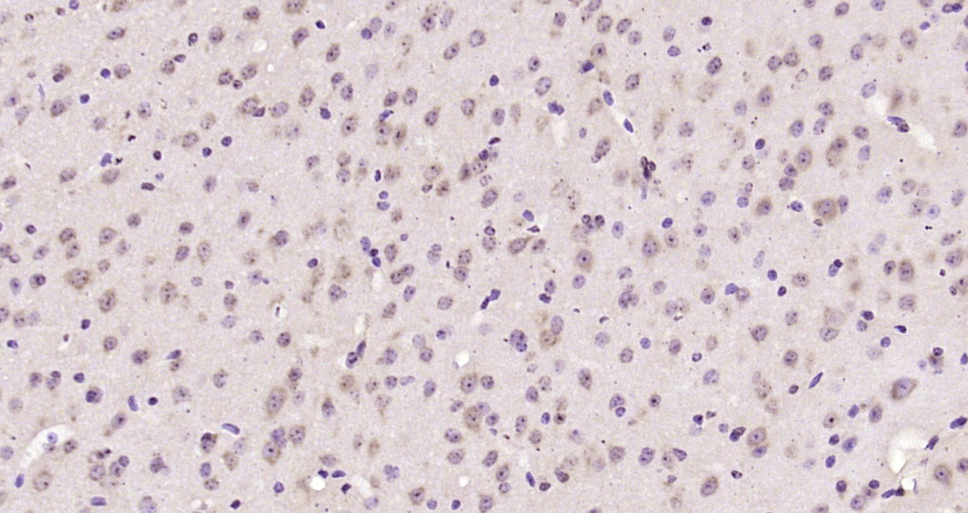 Paraformaldehyde-fixed, paraffin embedded Mouse brain; Antigen retrieval by boiling in sodium citrate buffer (pH6.0) for 15min; Block endogenous peroxidase by 3% hydrogen peroxide for 20 minutes; Blocking buffer (normal goat serum) at 37°C for 30min; Antibody incubation with DNAJB6 Polyclonal Antibody, Unconjugated (bs-4949R) at 1:200 overnight at 4°C, DAB staining.