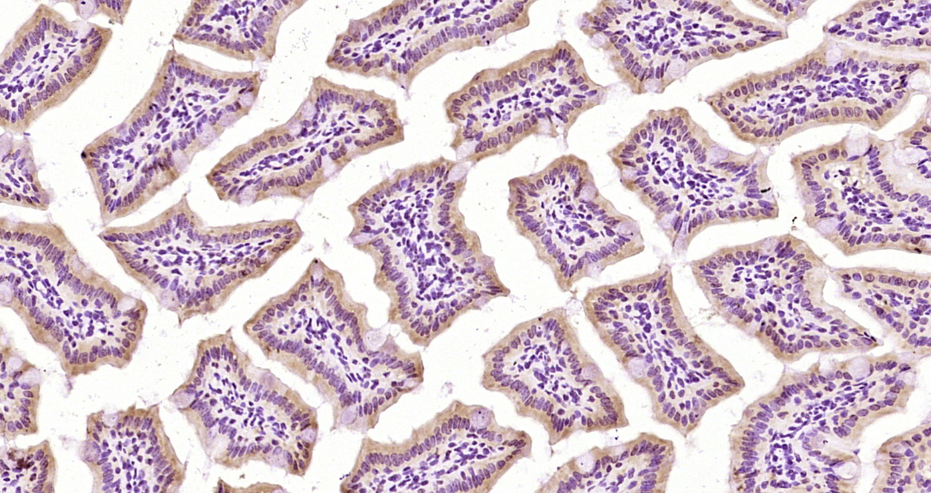 Paraformaldehyde-fixed, paraffin embedded Mouse intestine; Antigen retrieval by boiling in sodium citrate buffer (pH6.0) for 15min; Block endogenous peroxidase by 3% hydrogen peroxide for 20 minutes; Blocking buffer (normal goat serum) at 37°C for 30min; Antibody incubation with LASS5 Polyclonal Antibody, Unconjugated (bs-5082R) at 1:200 overnight at 4°C, DAB staining.