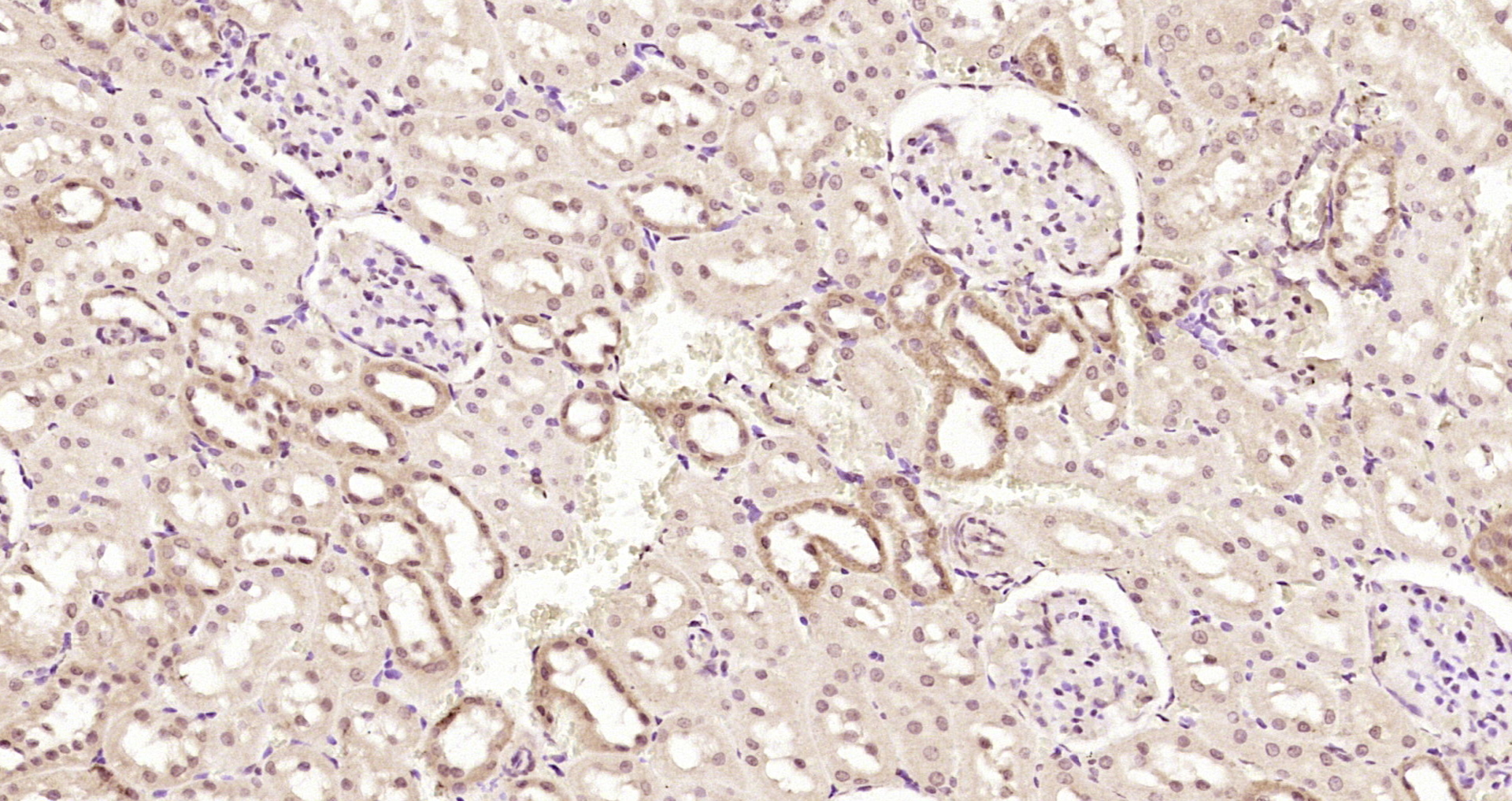 Paraformaldehyde-fixed, paraffin embedded Rat kidney; Antigen retrieval by boiling in sodium citrate buffer (pH6.0) for 15min; Block endogenous peroxidase by 3% hydrogen peroxide for 20 minutes; Blocking buffer (normal goat serum) at 37°C for 30min; Antibody incubation with PNPO Polyclonal Antibody, Unconjugated (bs-5108R) at 1:200 overnight at 4°C, DAB staining.
