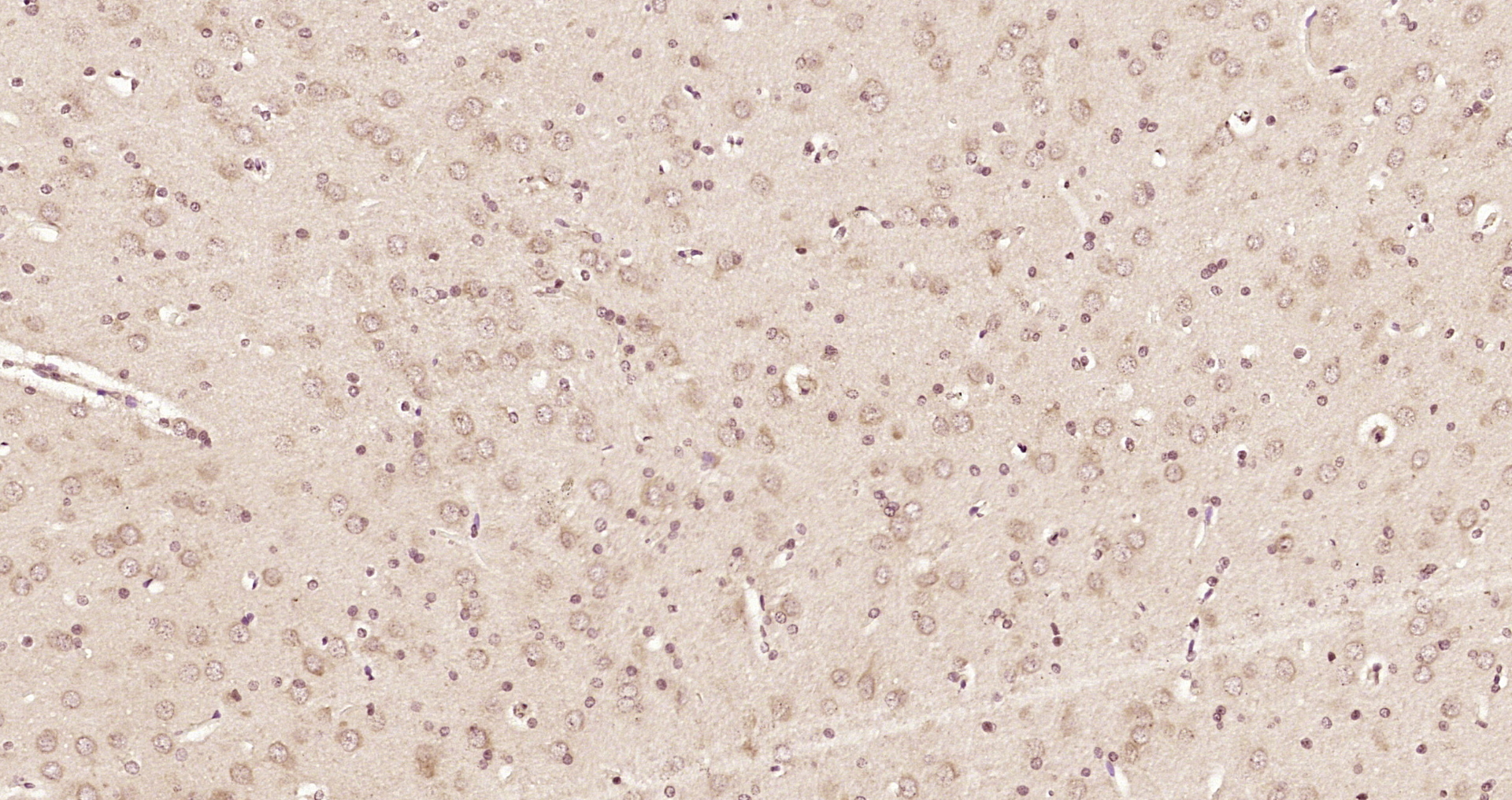 Paraformaldehyde-fixed, paraffin embedded Rat brain; Antigen retrieval by boiling in sodium citrate buffer (pH6.0) for 15min; Block endogenous peroxidase by 3% hydrogen peroxide for 20 minutes; Blocking buffer (normal goat serum) at 37°C for 30min; Antibody incubation with PNPO Polyclonal Antibody, Unconjugated (bs-5108R) at 1:200 overnight at 4°C, DAB staining.
