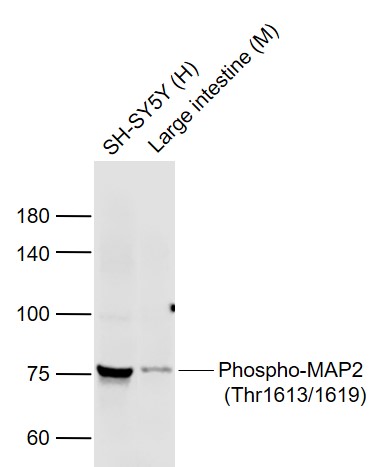 Lane 1: Human SH-SY5Y cell lysates; Lane 2: Mouse Large intestine lysates probed with MAP2 Polyclonal Antibody, Unconjugated (bs-16042R) at 1:1000 dilution and 4˚C overnight incubation. Followed by conjugated secondary antibody incubation at 1:20000 for 60 min at 37˚C.