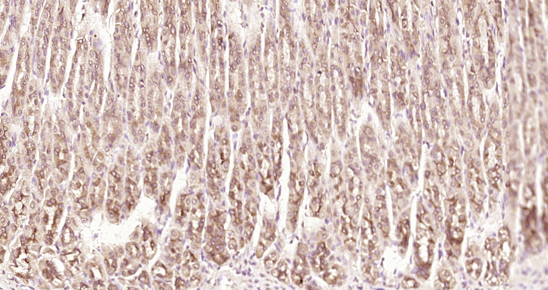 Paraformaldehyde-fixed, paraffin embedded Rat stomach; Antigen retrieval by boiling in sodium citrate buffer (pH6.0) for 15min; Block endogenous peroxidase by 3% hydrogen peroxide for 20 minutes; Blocking buffer (normal goat serum) at 37°C for 30min; Antibody incubation with PNPO Polyclonal Antibody, Unconjugated (bs-5108R) at 1:200 overnight at 4°C, DAB staining.