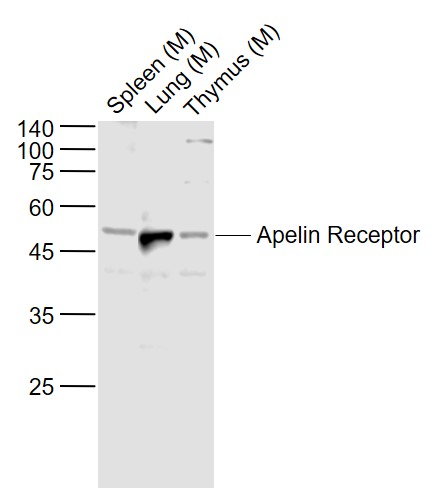 Lane 1: Mouse Spleen lysates; Lane 2: Mouse Lung lysates; Lane 3: Mouse Thymus lysates probed with Apelin Receptor Polyclonal Antibody, Unconjugated (bs-21310R) at 1:1000 dilution and 4˚C overnight incubation. Followed by conjugated secondary antibody incubation at 1:20000 for 60 min at 37˚C.
