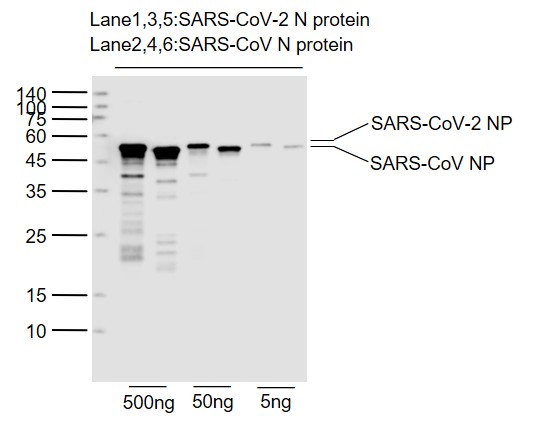 Lane 1, 3, 5: SARS-CoV-2 N protein (Cat# bs-41417P); Lane 2, 4, 6: SARS-CoV N protein (Cat# bs-49002P); probed with SARS-CoV-2 (1E8) Nucleocapsid protein Monoclonal Antibody, Unconjugated (bsm-41268M) at 1:1000 dilution and 4˚C overnight incubation. Followed by conjugated secondary antibody incubation at 1:20000 for 60 min at 37˚C. Lane 1, 3, 5: SARS-CoV-2 N protein (Cat# bs-41417P); Lane 2, 4, 6: SARS-CoV N protein (Cat# bs-49002P); probed with SARS-CoV-2 (1E8) Nucleocapsid protein Monoclonal Antibody, Unconjugated (bsm-41268M) at 1:1000 dilution and 4˚C overnight incubation. Followed by conjugated secondary antibody incubation at 1:20000 for 60 min at 37˚C.
