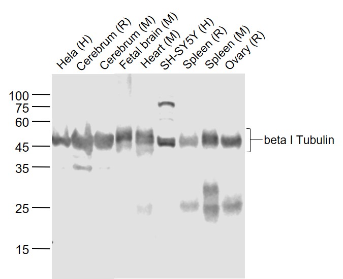 Lane 1: Human Hela cell lysates; Lane 2: Rat Cerebrum lysates; Lane 3: Mouse Cerebrum lysates; Lane 4: Mouse Fetal brain lysates; Lane 5: Mouse Heart lysates; Lane 6: Human SH-SY5Y cell lysates; Lane 7: Rat Spleen lysates; Lane 8: Mouse Spleen lysates; Lane 9: Rat Ovary lysates probed with beta 1 Tubulin (5F7) Monoclonal Antibody, Unconjugated (bsm-33041M) at 1:1000 dilution and 4˚C overnight incubation. Followed by conjugated secondary antibody incubation at 1:20000 for 60 min at 37˚C.