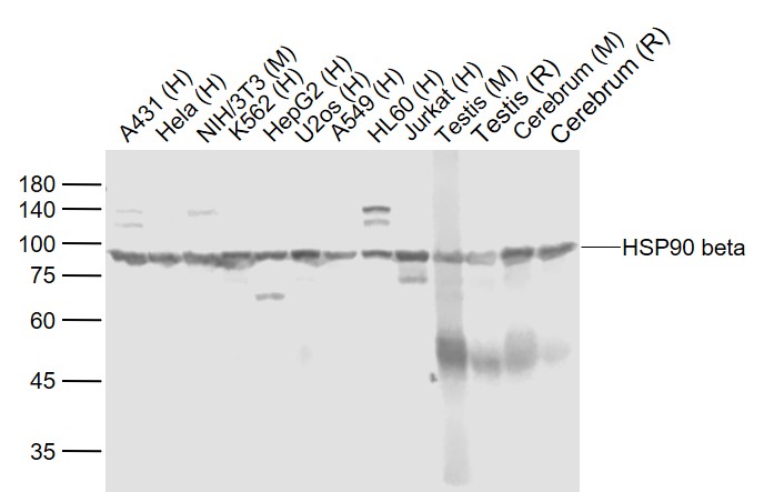 Lane 1: Human A431cell lysates; Lane 2: Human Hela cell lysates; Lane 3: Mouse NIH/3T3 cell lysates; Lane 4: Human K562 cell lysates; Lane 5: Human HepG2 cell lysates; Lane 6: Human U-2OS cell lysates; Lane 7: Human A549 cell lysates; Lane 8: Human HL-60 cell lysates; Lane 9: Human Jurkat cell lysates; Lane 10: Mouse Testis lysates; Lane 11: Rat Testis lysates; Lane 12: Mouse Cerebrum lysates; Lane 13: Rat Cerebrum lysates probed with HSP90 beta Monoclonal Antibody, Unconjugated (bsm-33136M) at 1:1000 dilution and 4˚C overnight incubation. Followed by conjugated secondary antibody incubation at 1:20000 for 60 min at 37˚C.